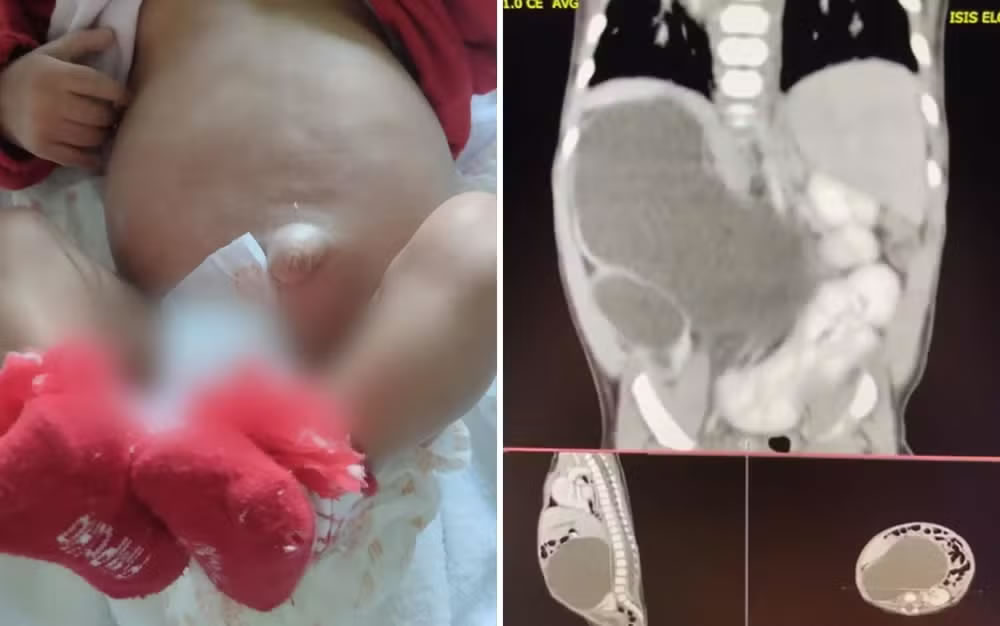 Bebê Isis Eloah Ferreira Alves nasceu com quatro rins — Foto: Arquivo pessoal/Thalia Silva Alves